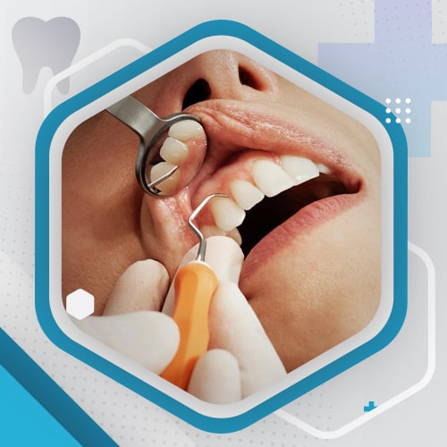 Preventative Dentistry – Dental Hygeine - Tsawwassen Commons